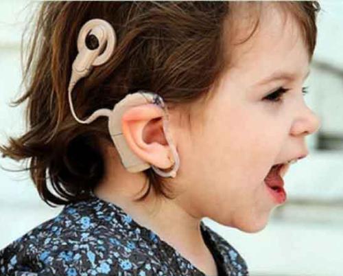 Cuba guarantees over 500 cochlear implants